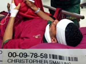 Obránce Manchesteru United Chris Smalling byl s poraněním hlavy převezen do nemocnice v Bali